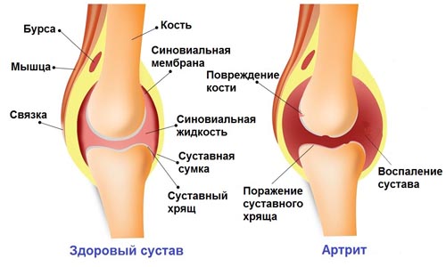 Настойка гриба Веселка. Применение, инструкция, от каких болезней, польза, вред, как приготовить