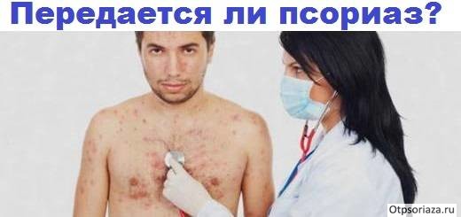 Как передается псориаз от человека