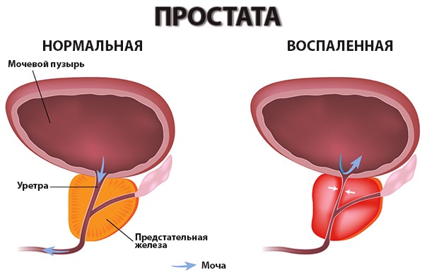 Настойка гриба Веселка. Применение, инструкция, от каких болезней, польза, вред, как приготовить