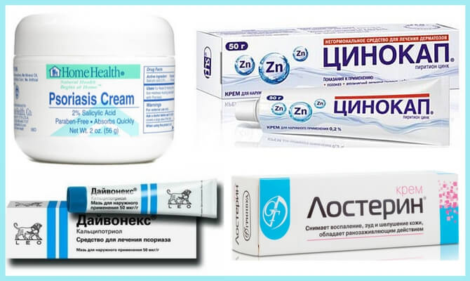 популярные негормональные мази от псориаза