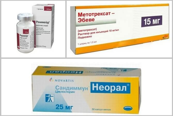 препараты от псориаза на голове