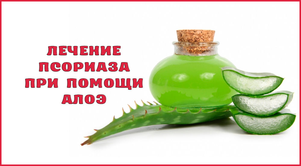 Применение алоэ при лечении псориаза