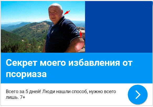 Псориаз к какому врачу обратиться