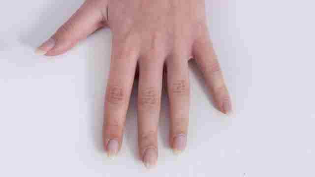 psoriaisis-artrit-start