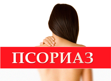 лечение псориаза в санатории