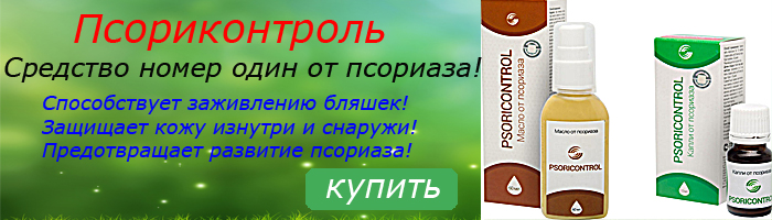 псориаз болят ноги