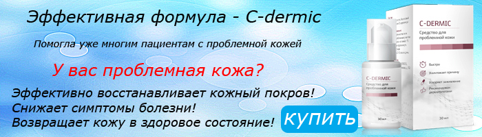 псориаз болят ноги