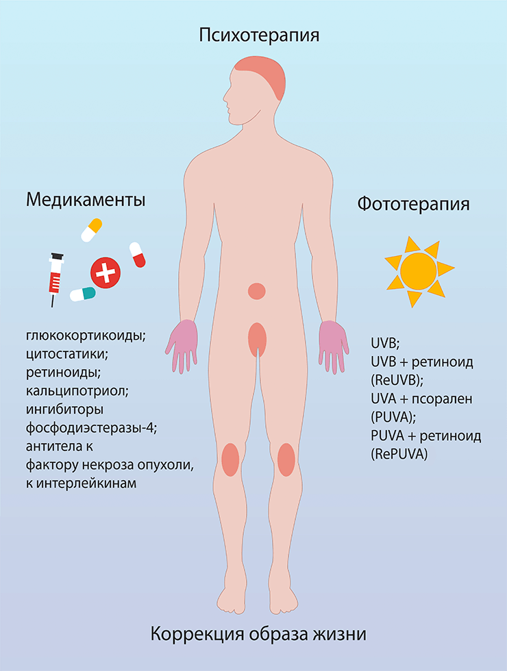 псориаз рисунок-2