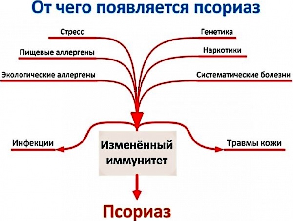 Псориаз у детей. Фото, стадии, причины и лечение, рекомендации врачей