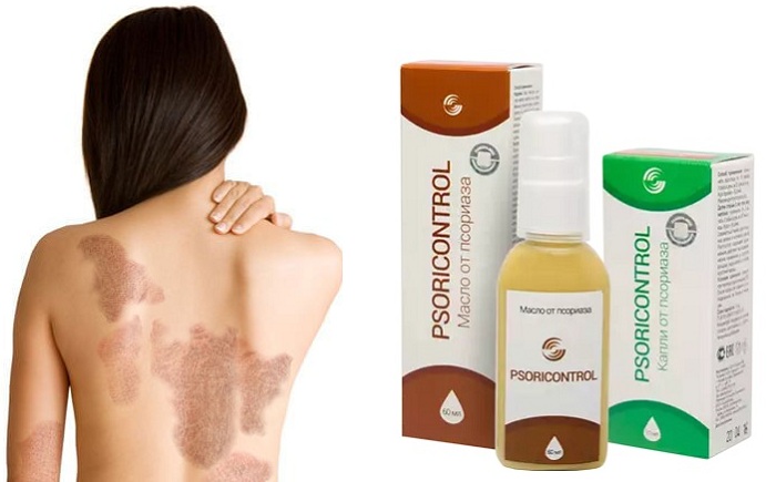 psorikontrol-osobennosti