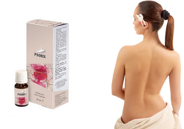 Psorix от псориаза: действует там, где другие препараты бессильны!