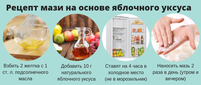 Рецепт мази на основе яблочного уксуса