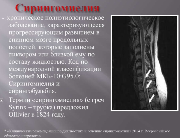 Санатории Саки с лечением опорно-двигательного аппарата и суставов. Цены, отзывы