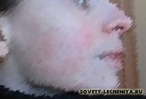 seborejnyj-dermatit-lechenie