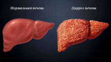 Головные боли