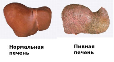 Расстройства органов пищеварения