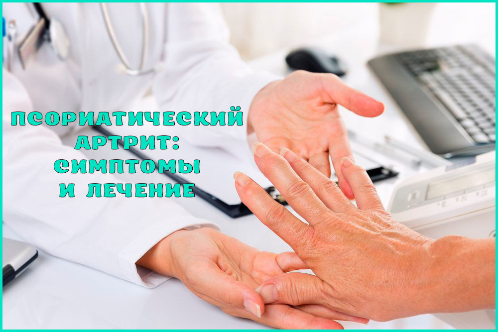 Симптомы и лечение псориатического артрита