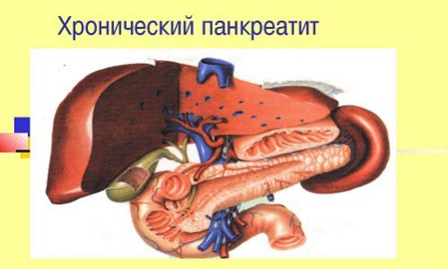 pankreatit-simptomy