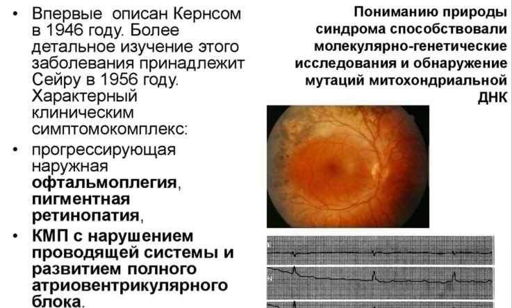 Классификация и причины генетических болезней
