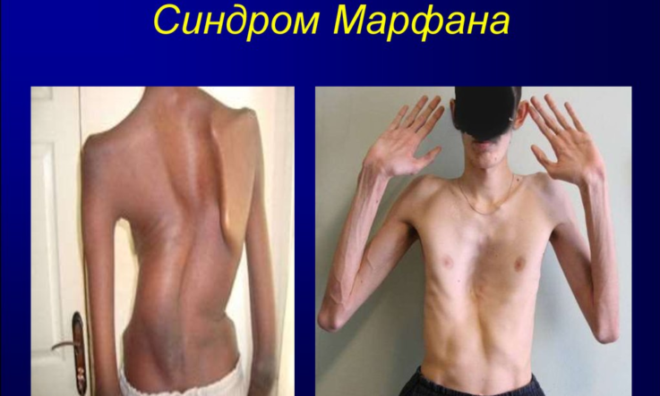 Классификация и причины генетических болезней
