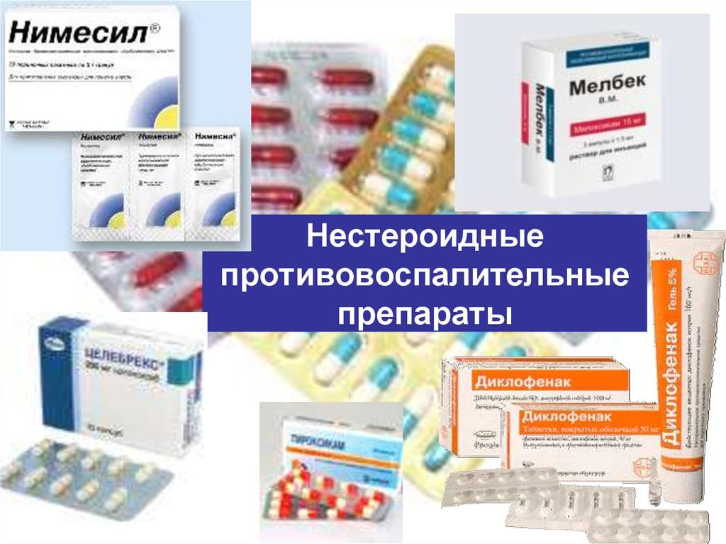 Ревматоидный артрит симптомы причины лечение