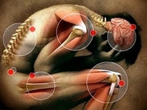 Периферический спондилоартрит что это такое