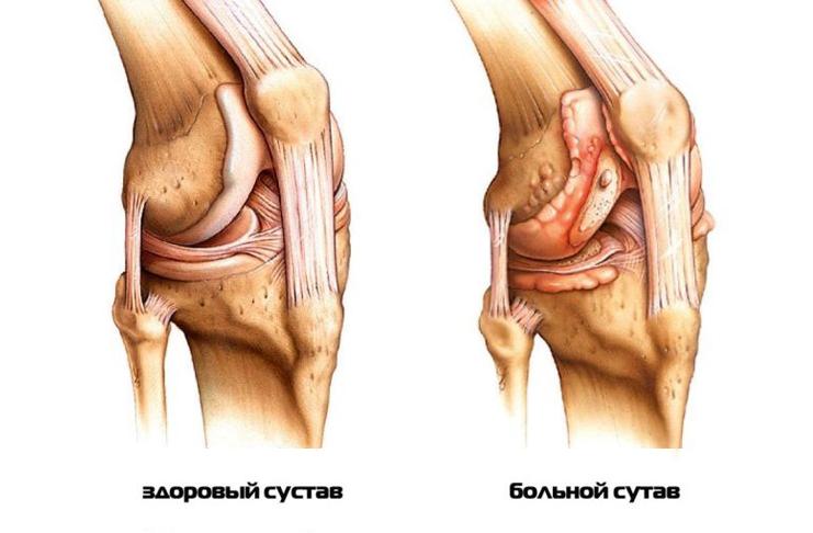 Строение коленного сустава