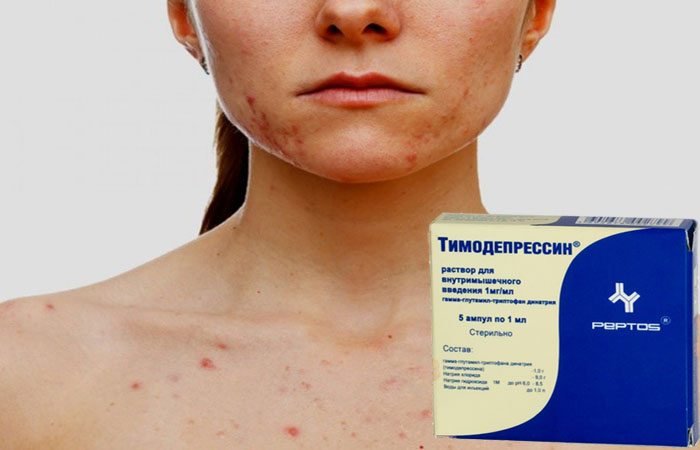 Тимодепрессин от псориаза фармокологические свойства