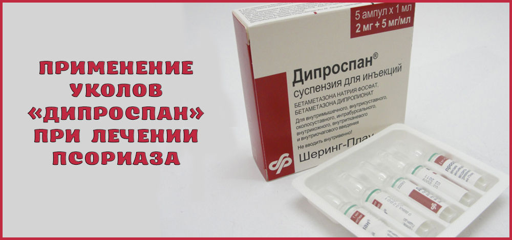 Уколы «Дипроспан» при псориазе