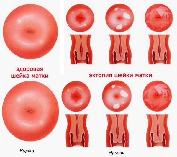 Ванна с солью. Польза и вред, рецепты с морской, поваренной, обычной пищевой