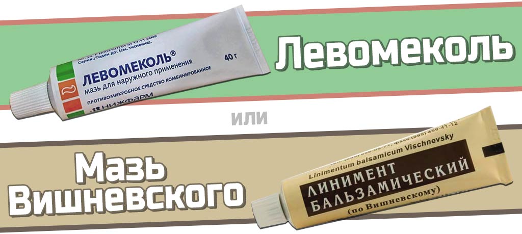 vybor