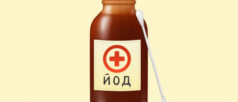 Можно ли мазать лишай йодом? Как йодом проверить лишай