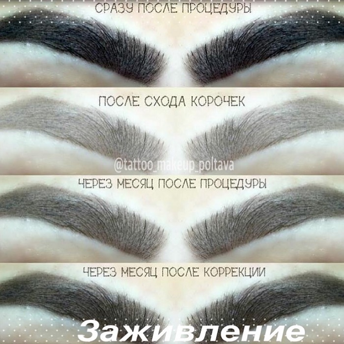 Заживление татуажа