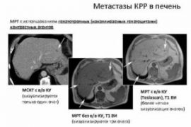 С чем можно спутать ветрянку у детей?