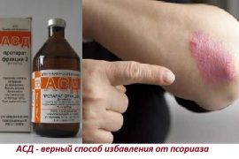 Фракция АСД 2 при псориазе