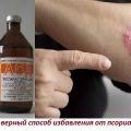 Фракция Асд при псориазе