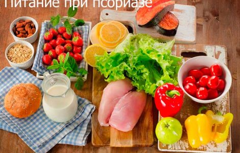 Псориаз волосистой части головы