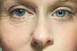 Что можно и нельзя есть при псориазе?