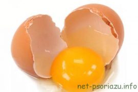 Как вылечить псориаз ногтей?