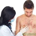 Как начинается псориаз: симптомы и признаки болезни