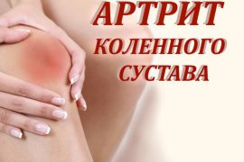 Артрит коленного сустава: причины, симптомы и лечение