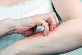 Правила питания при псориазе – подробное меню и таблица продуктов