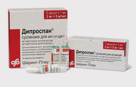 Дипроспан уколы