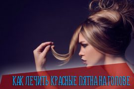 Почему на коже появляются белые пятна