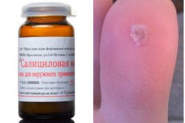 От чего помогает салициловая мазь