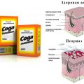 Лечение псориаза пищевой содой