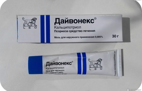 Самые эффективные мази для лечения псориаза кожи тела