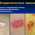 Псориатическая триада