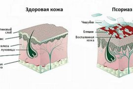 Лучшие мази, кремы и гели для тренировок и решения проблем