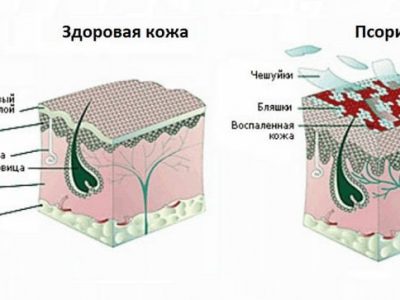 Лучшие мази, кремы и гели для тренировок и решения проблем